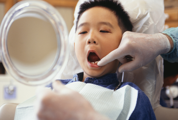 Child with mouth wide open in the dentist chair.