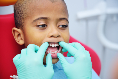 Niño recibiendo tratamiento en el consultorio del dentista.